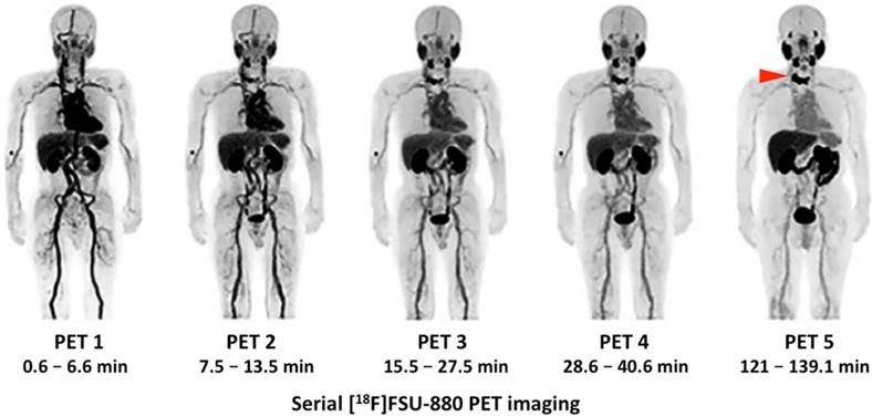 Theranostics Image