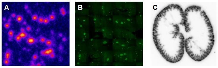 Theranostics Image