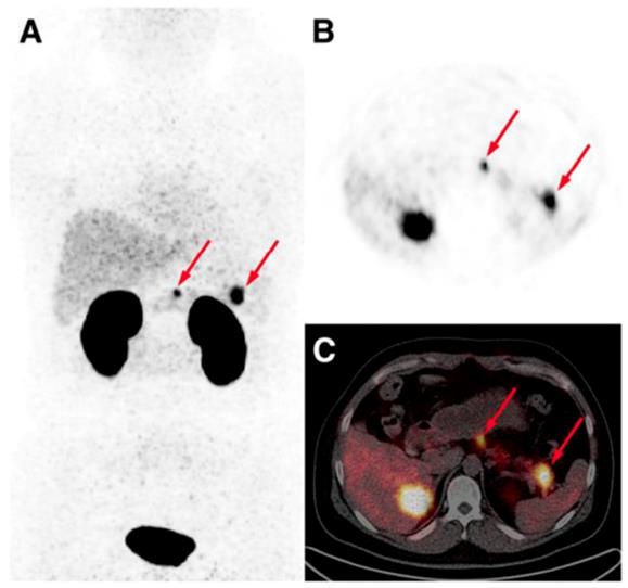 Theranostics Image