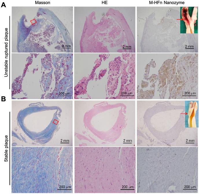 Theranostics Image