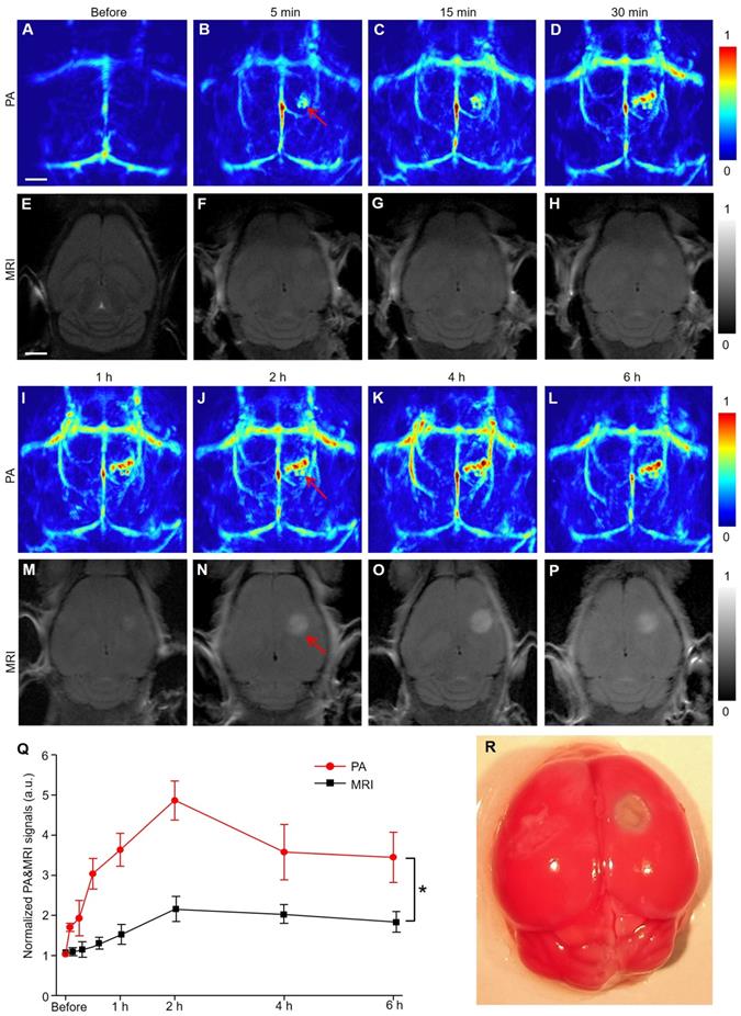 Theranostics Image