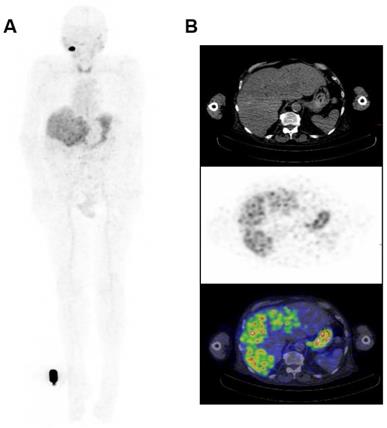 Theranostics Image