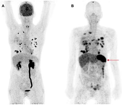 Theranostics Image