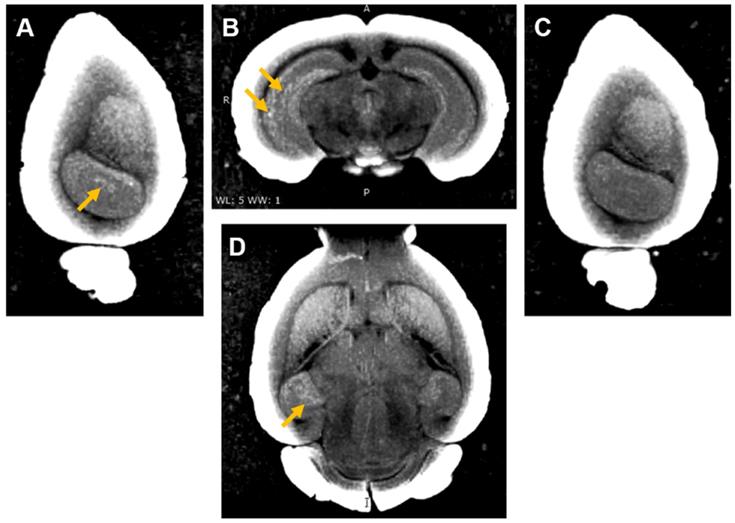 Theranostics Image