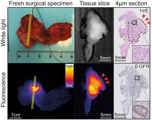 Theranostics Image