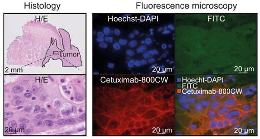 Theranostics Image