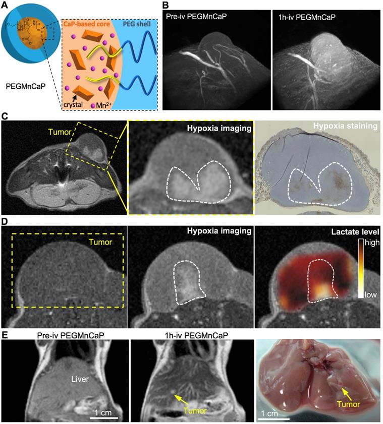 Theranostics Image