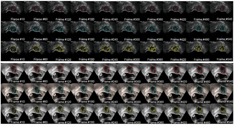 Theranostics Image