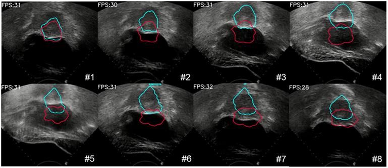 Theranostics Image