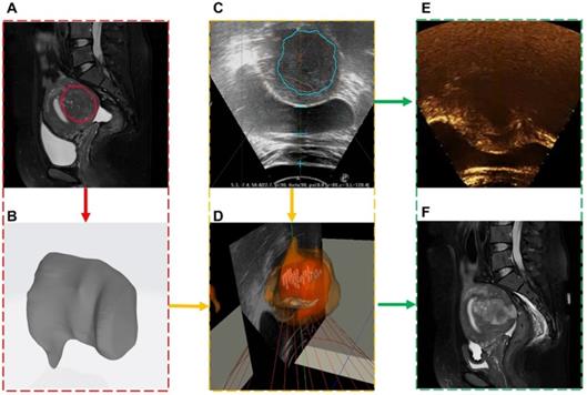 Theranostics Image