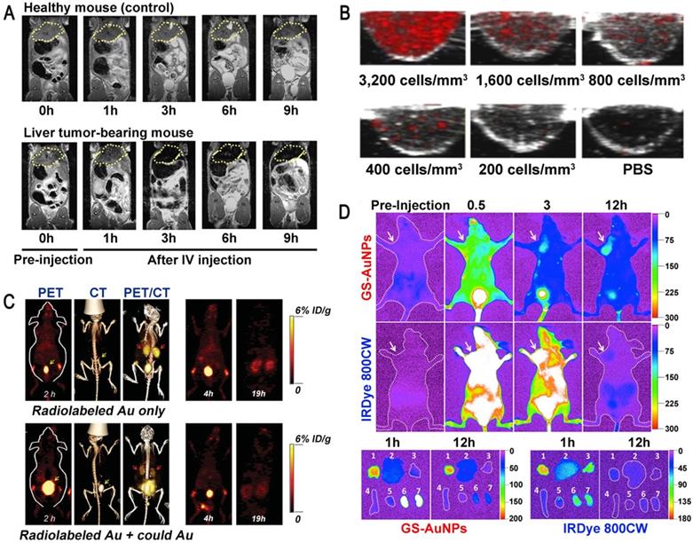 Theranostics Image