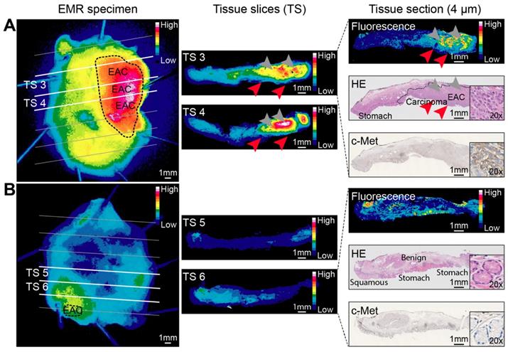 Theranostics Image