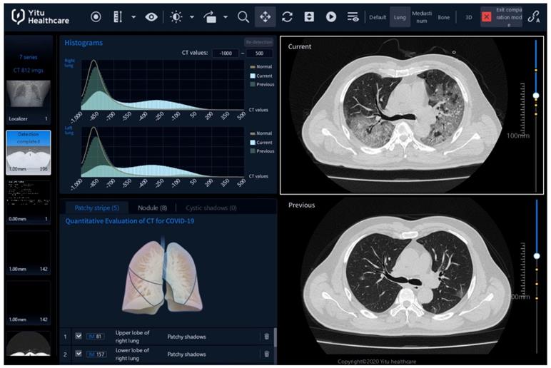 Theranostics Image