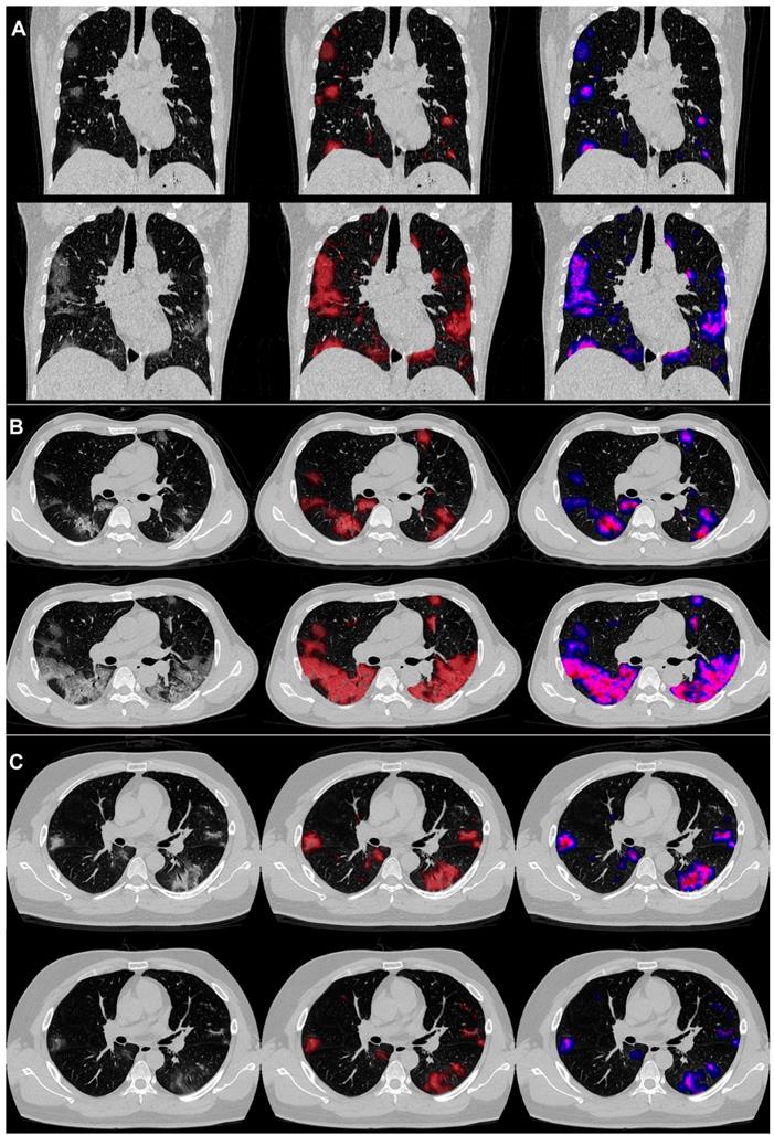 Theranostics Image