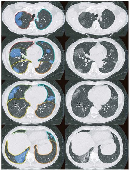 Theranostics Image