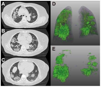 Theranostics Image