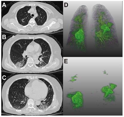 Theranostics Image