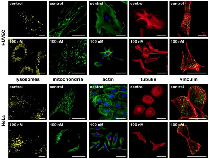 Theranostics Image