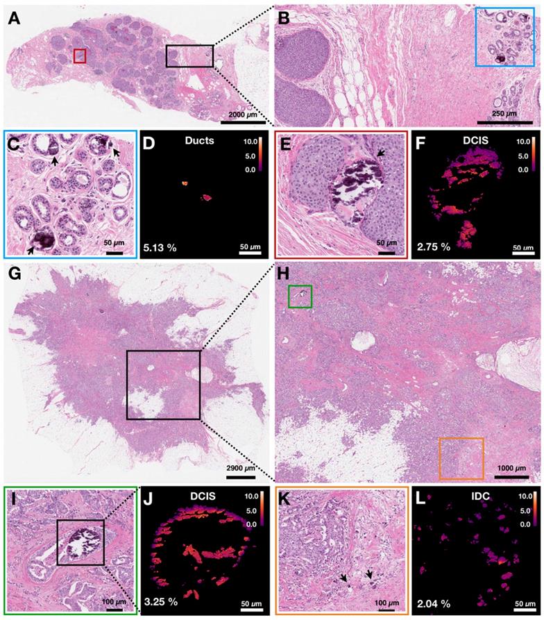 Theranostics Image