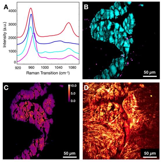 Theranostics Image