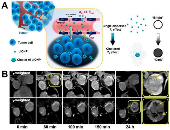 Theranostics Image