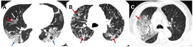 Theranostics Image