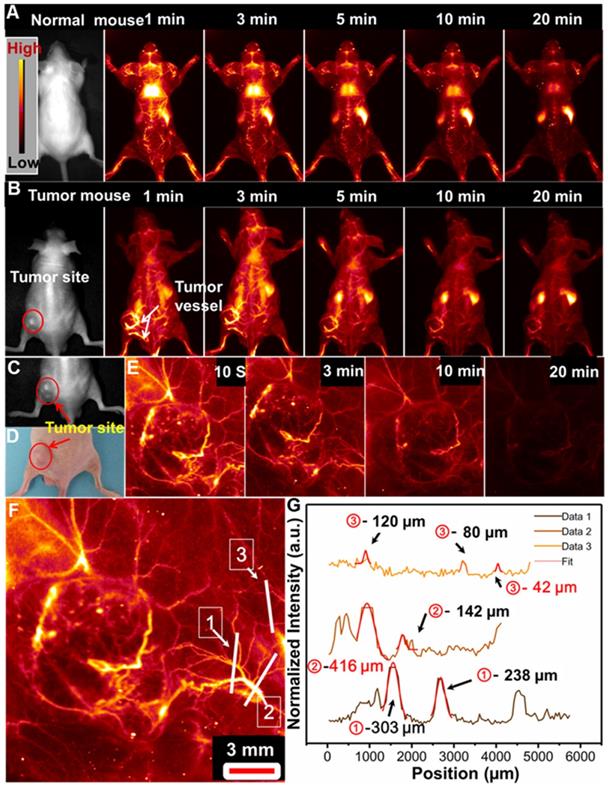 Theranostics Image