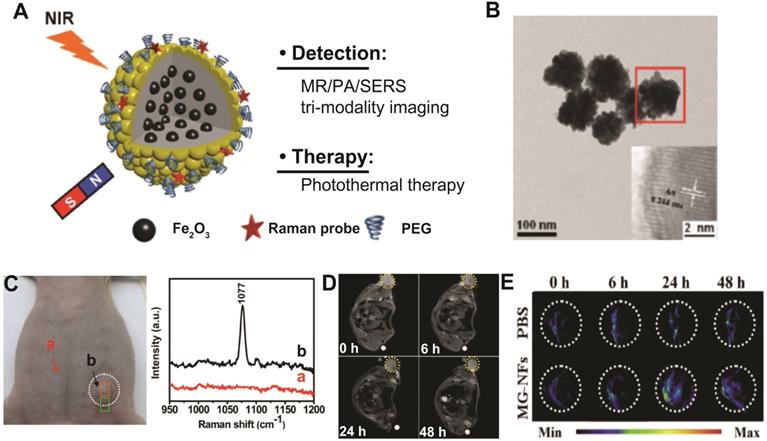 Theranostics Image