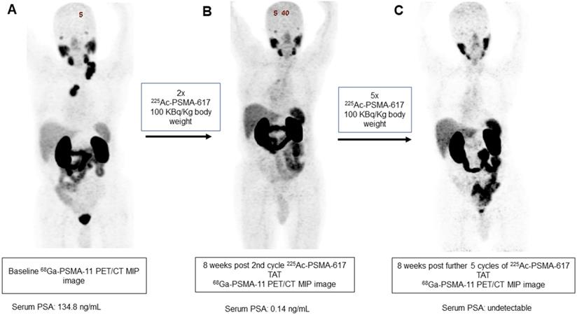 Theranostics Image