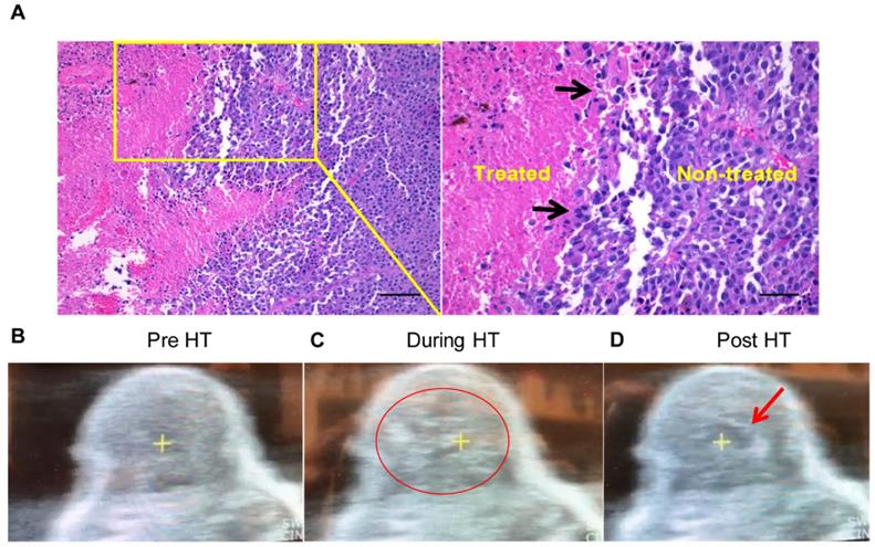 Theranostics Image