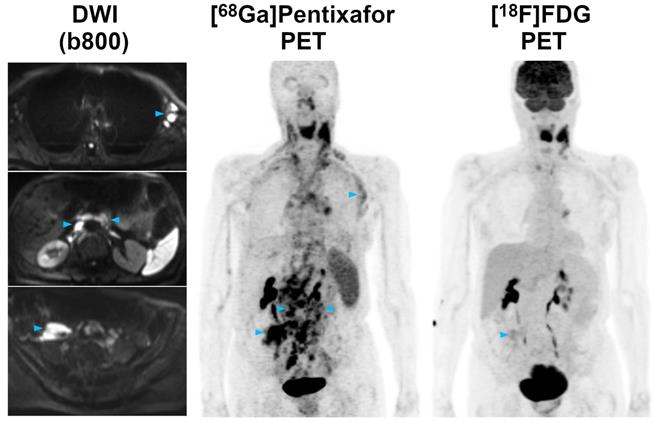 Theranostics Image