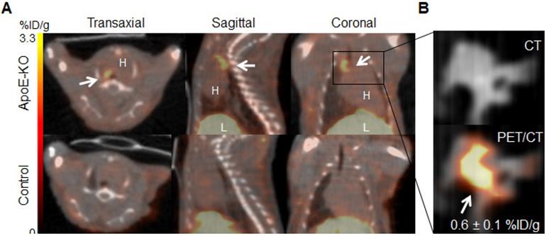 Theranostics Image