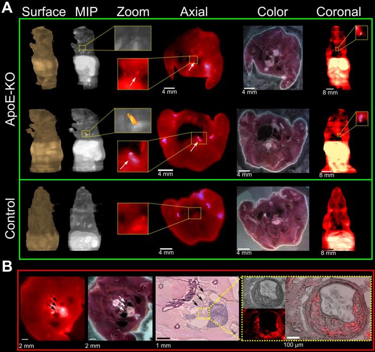 Theranostics Image