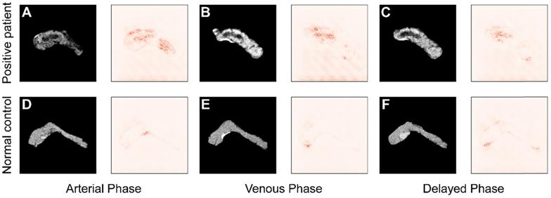 Theranostics Image