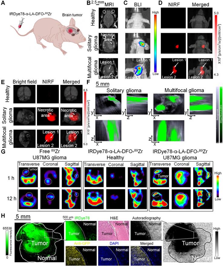 Theranostics Image