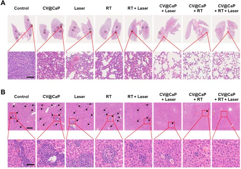 Theranostics Image