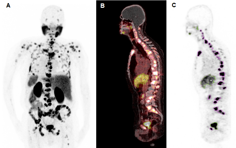 Theranostics Image