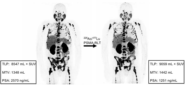 Theranostics Image