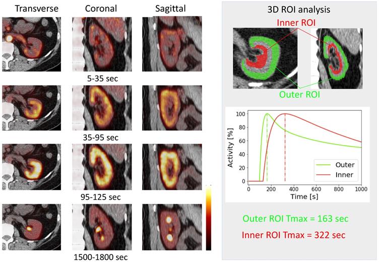 Theranostics Image