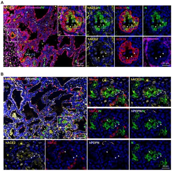 Theranostics Image