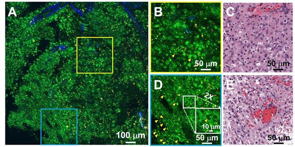 Theranostics Image