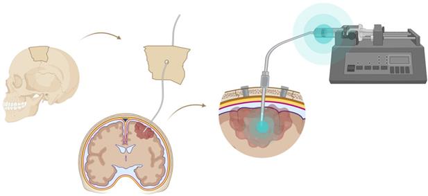 Theranostics Image