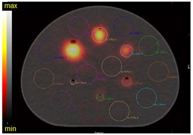 Theranostics Image