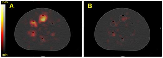 Theranostics Image