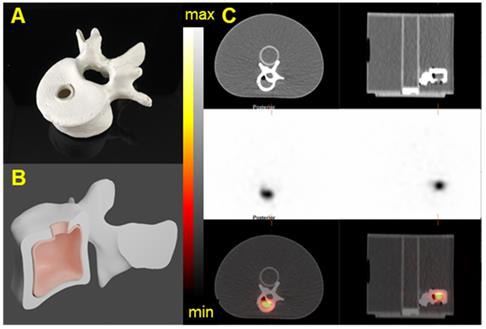 Theranostics Image