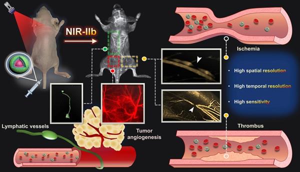 Theranostics Image