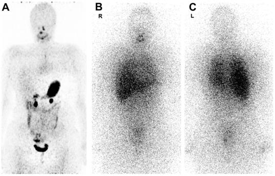 Theranostics Image