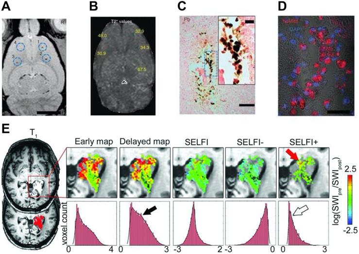 Theranostics Image