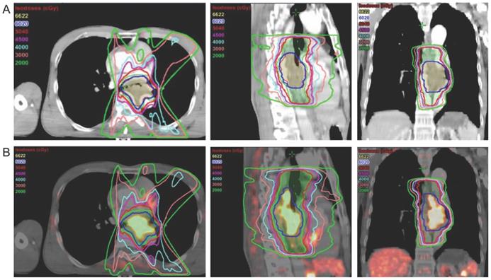 Theranostics Image