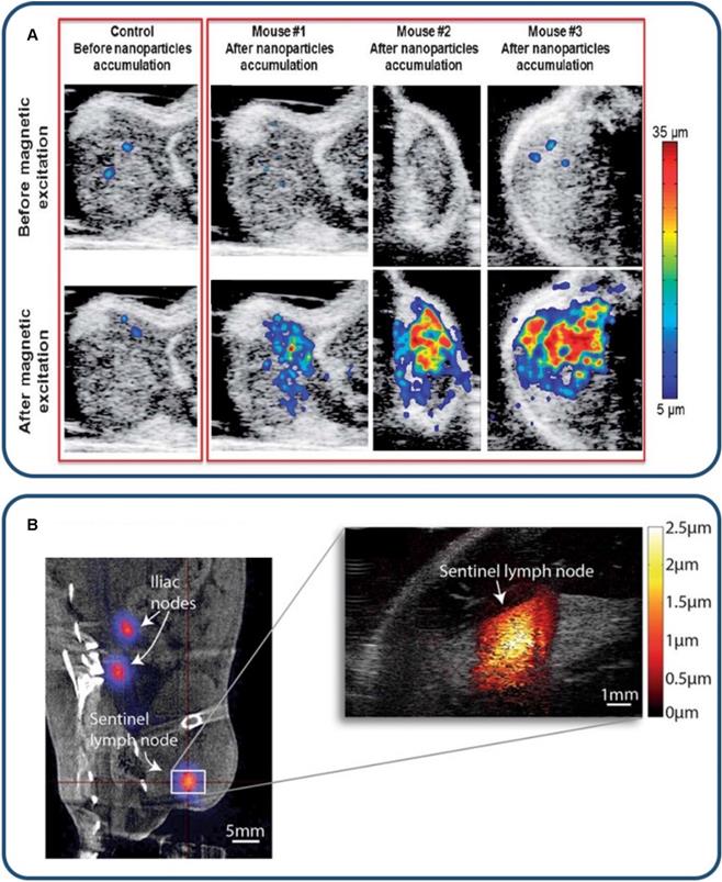 Theranostics Image